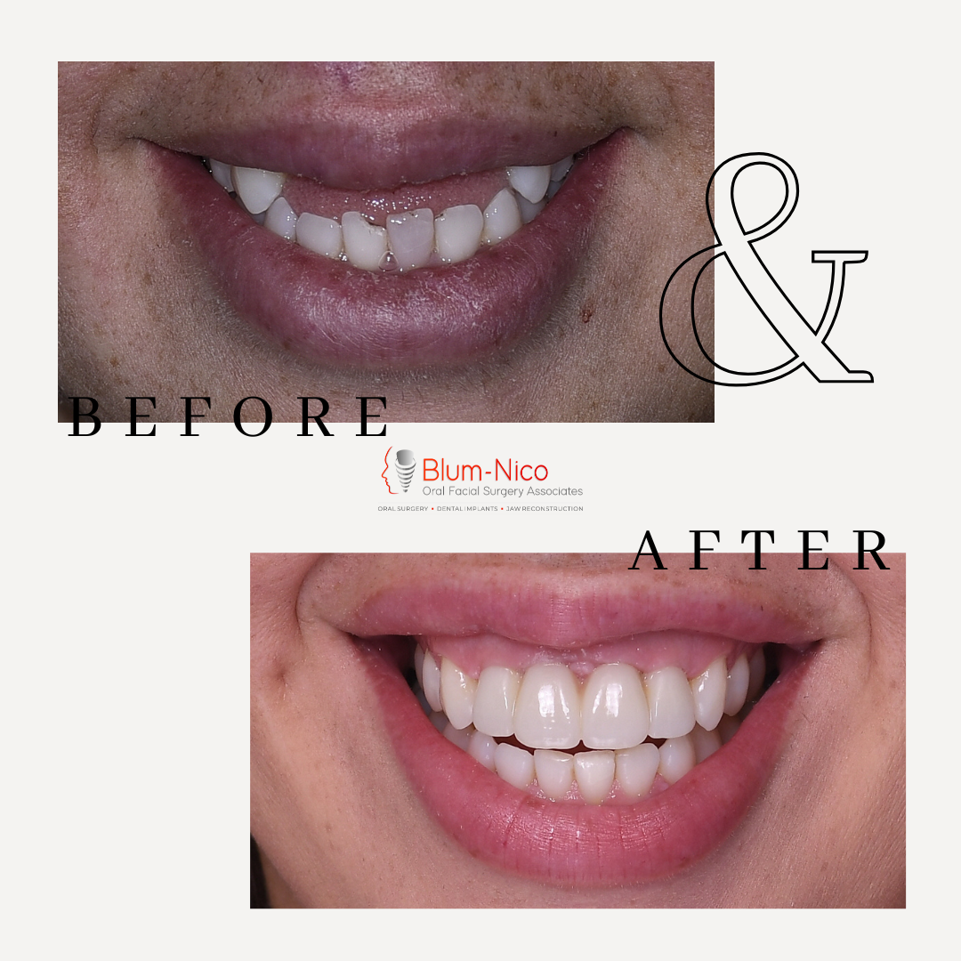 Blum-nico Oral Surgery Associates photo 6