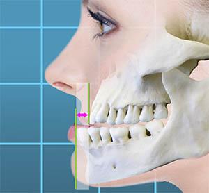Kurpis Center for Implant & Cosmetic Dentistry photo 2
