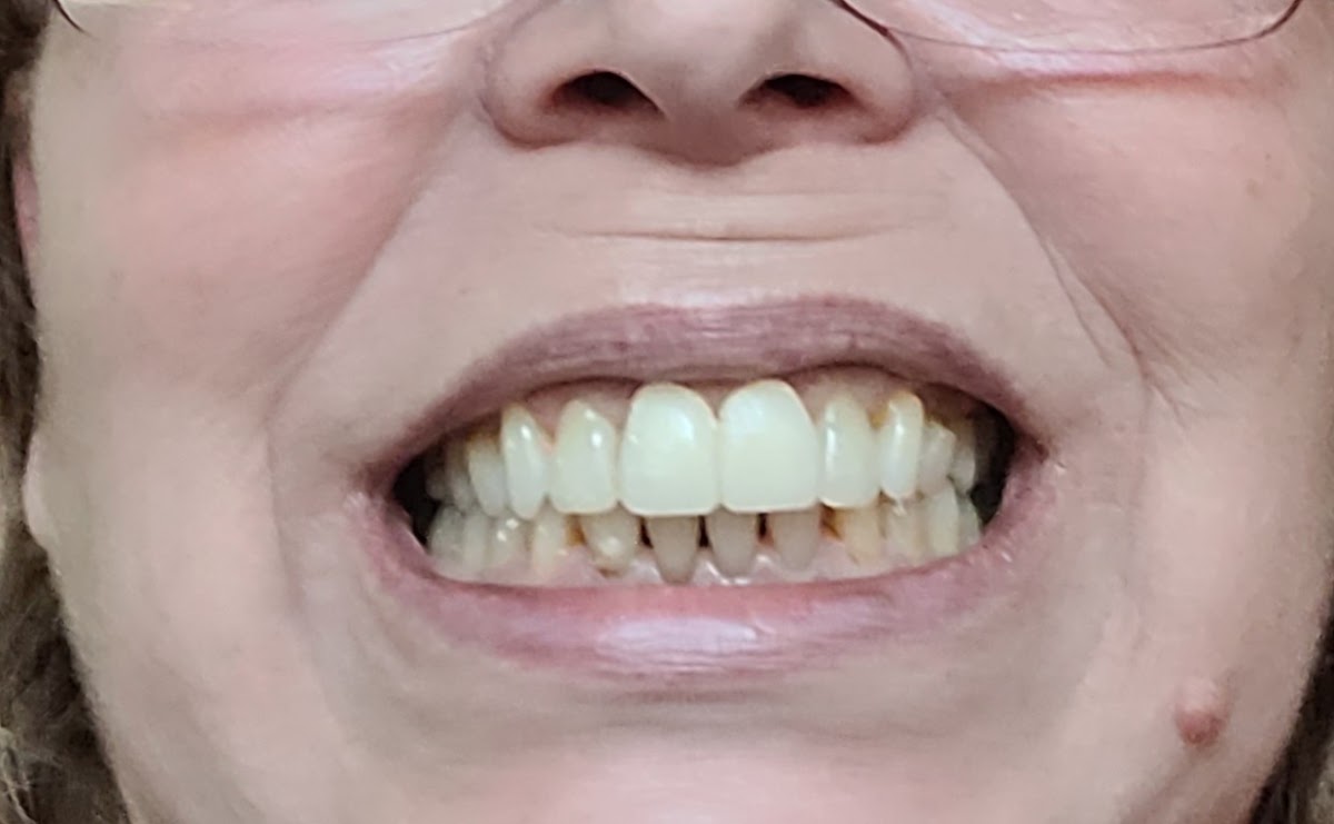 Kurpis Center for Implant & Cosmetic Dentistry photo 6