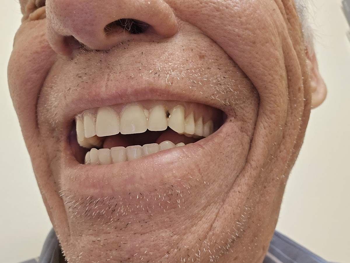 Affordable Dentures & Implants - Broken Arrow photo 5