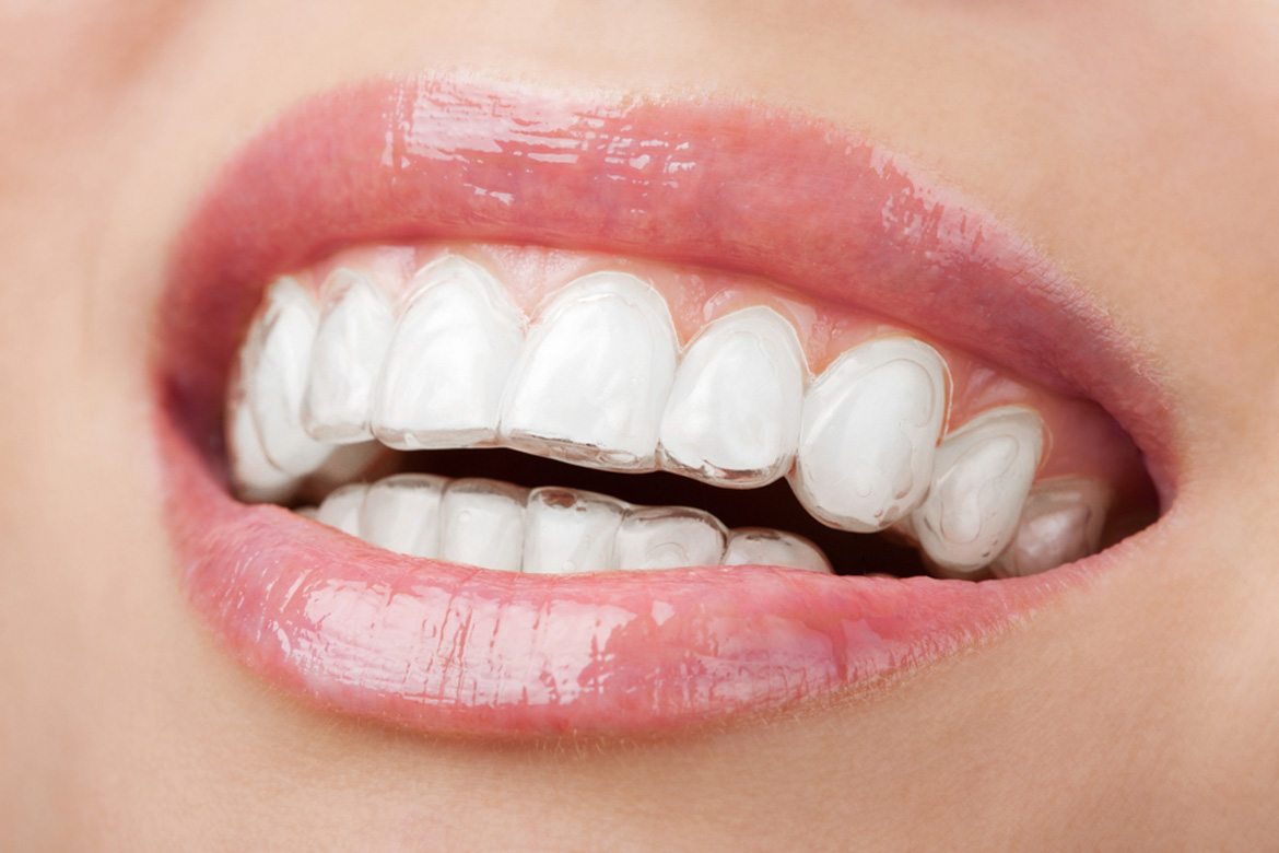 Tijuana Affordable Dental Implants photo 2