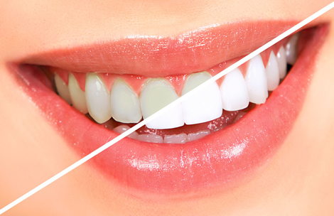 Tijuana Affordable Dental Implants photo 3