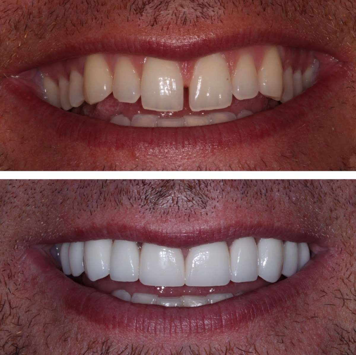 Sierra Smiles Complete Health Dentistry - Kietzke photo 5
