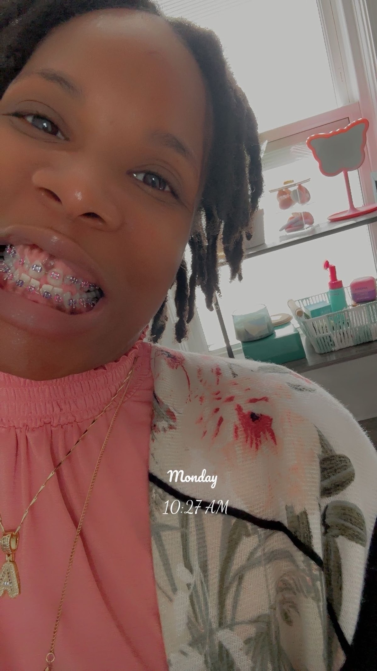 Celebrate Dental & Braces - St Joseph photo 5
