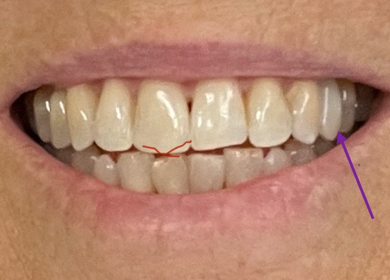 Charlottesville Dental photo 4