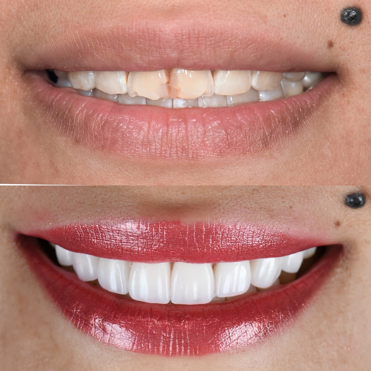 O2 Dental Group of Fayetteville photo 6