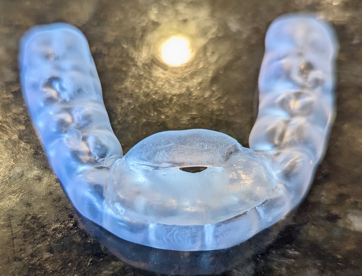 Implant & General Dentistry of Northern Colorado photo 2