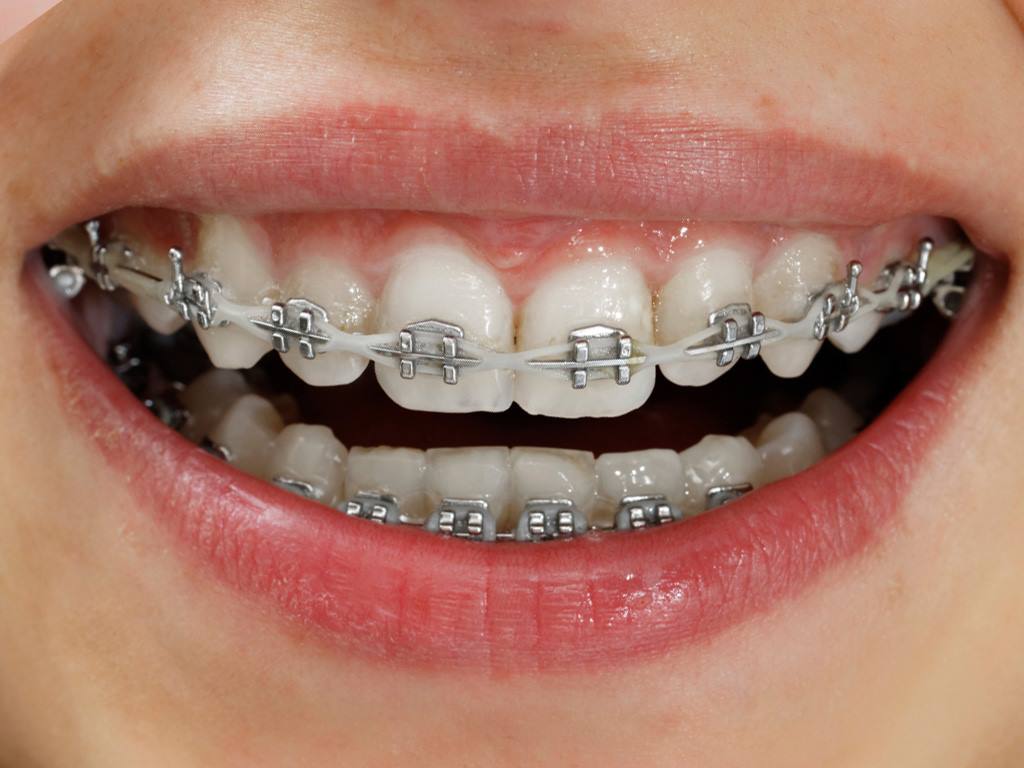 Pontchartrain Dental of Slidell photo 3