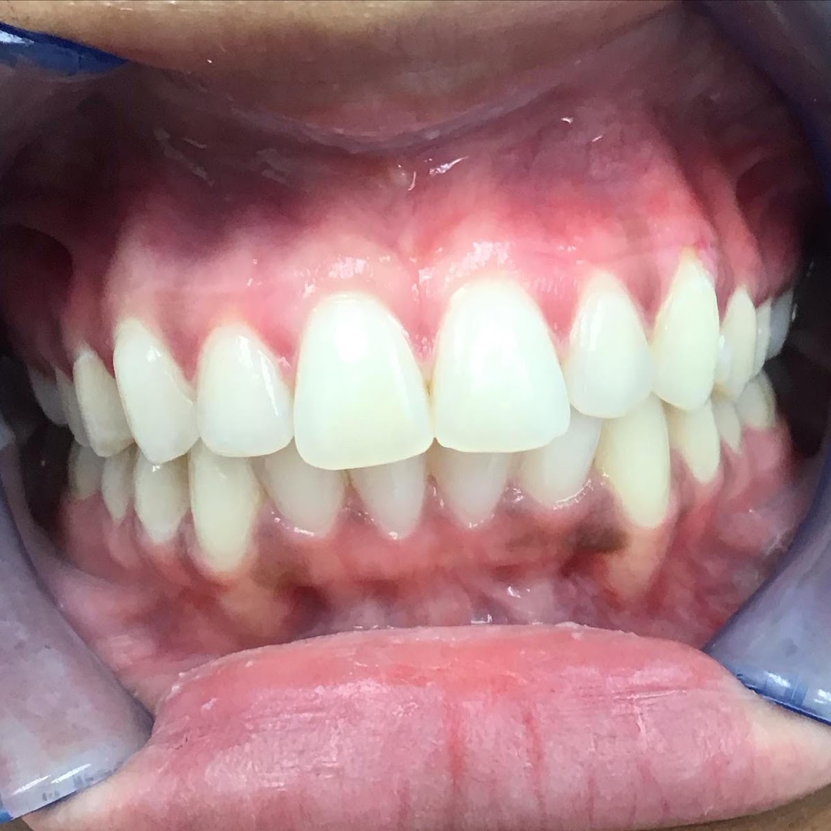 Aspen Hill Implant and Family Dentistry photo 3