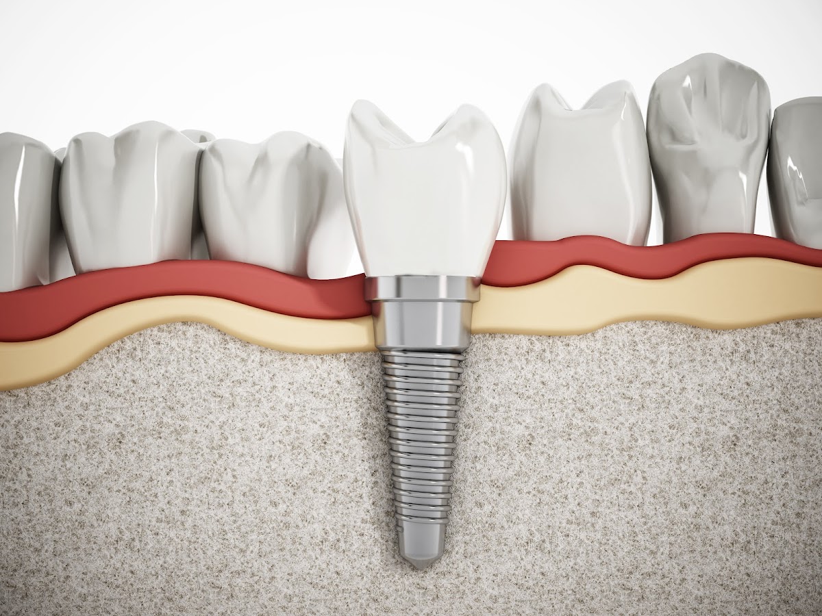 West Valley Oral Surgery photo 6