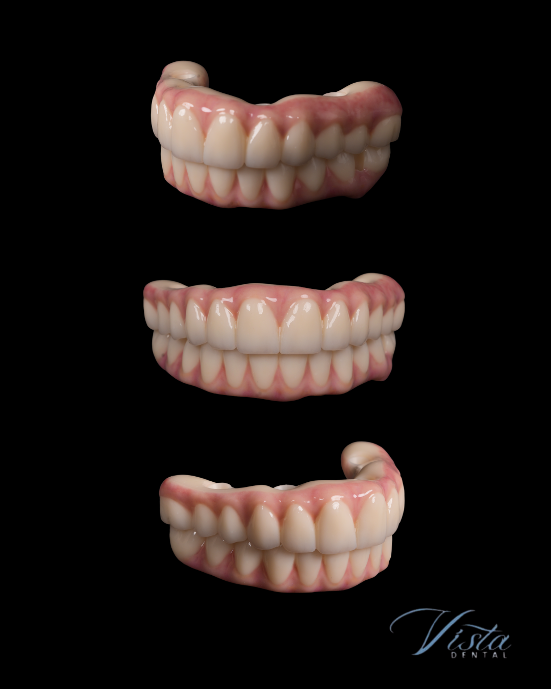 Vista Dental Implants photo 3