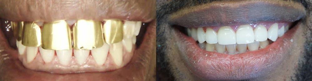 Jordan Family Dentistry photo 1