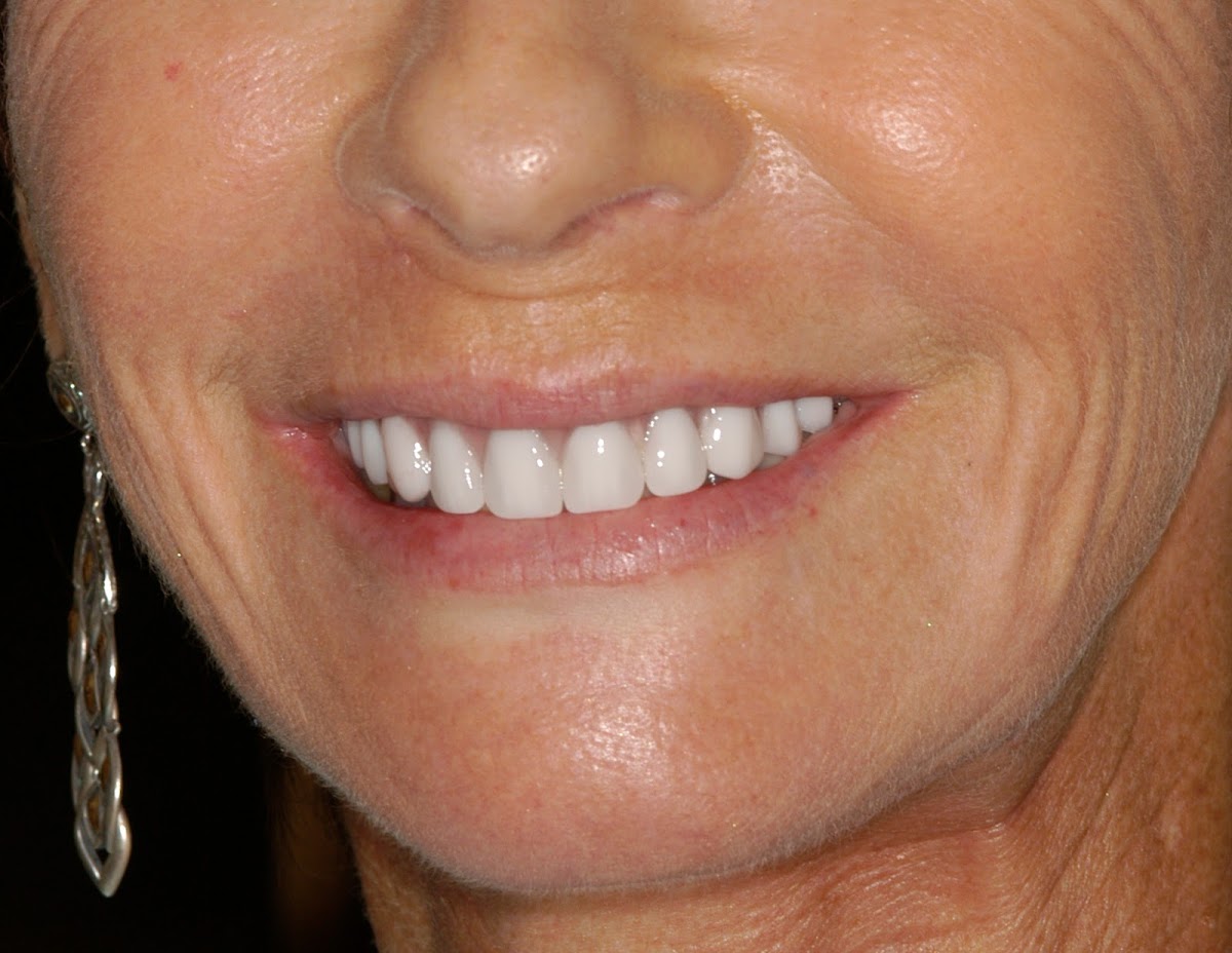 Good Samaritan Dental Implant Institute photo 2
