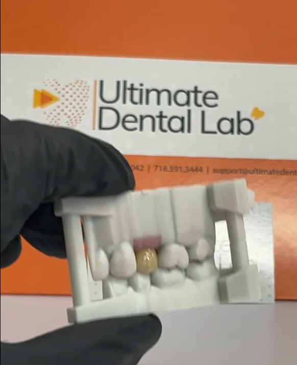 Ultimate Dental, Denture, Crown & Implants Lab photo 1