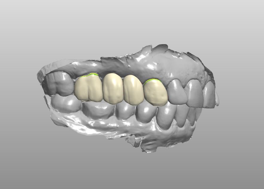 Stoller Dental Laboratory Inc photo 1