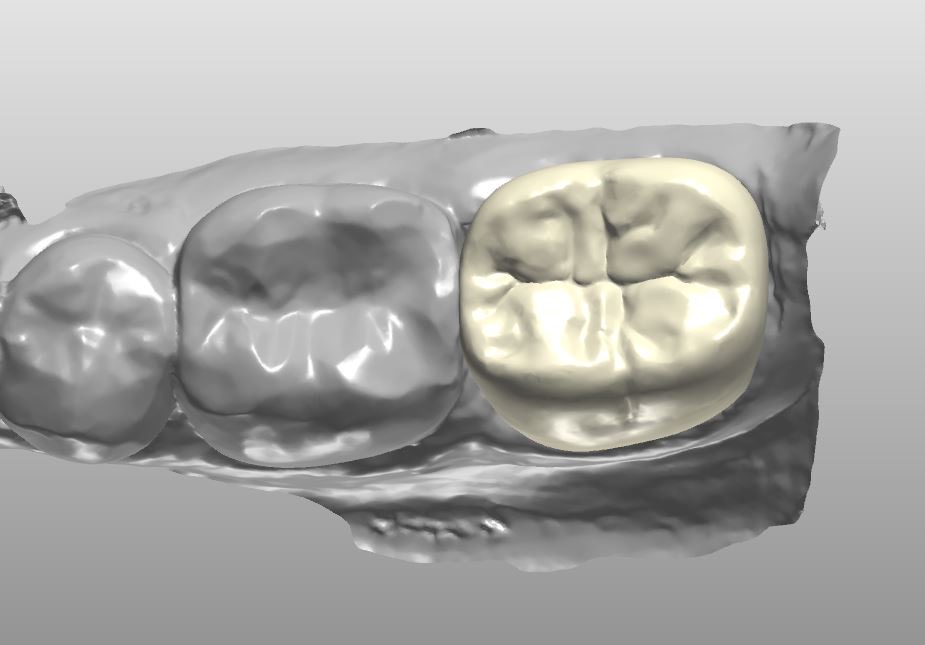 Stoller Dental Laboratory Inc photo 5