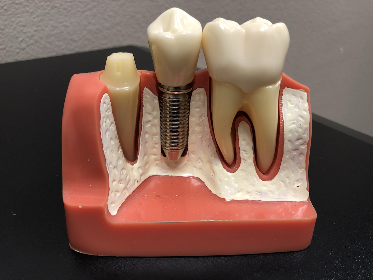 Serene Dental photo 3