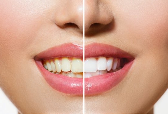 Victoria Village Dentistry: Dentist - Implant - Extraction photo 4