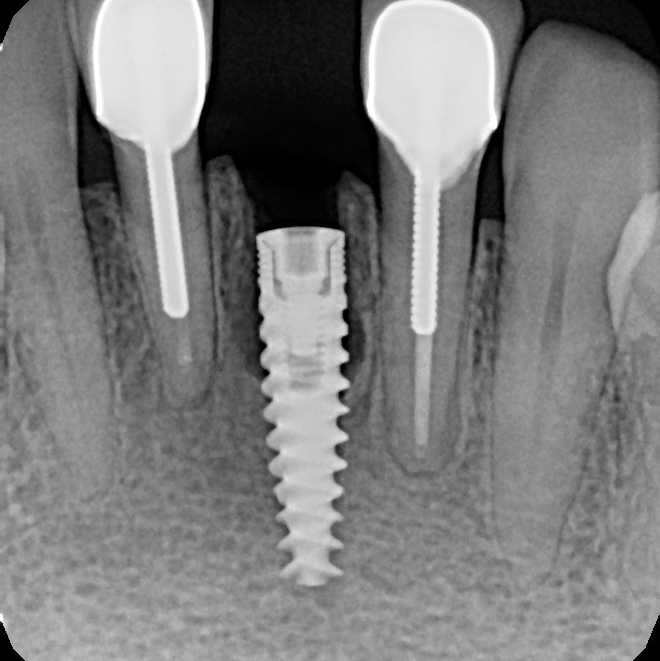 Bayside Periodontics & Dental Implants photo 2