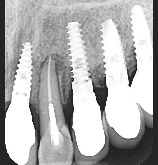 Bayside Periodontics & Dental Implants photo 3