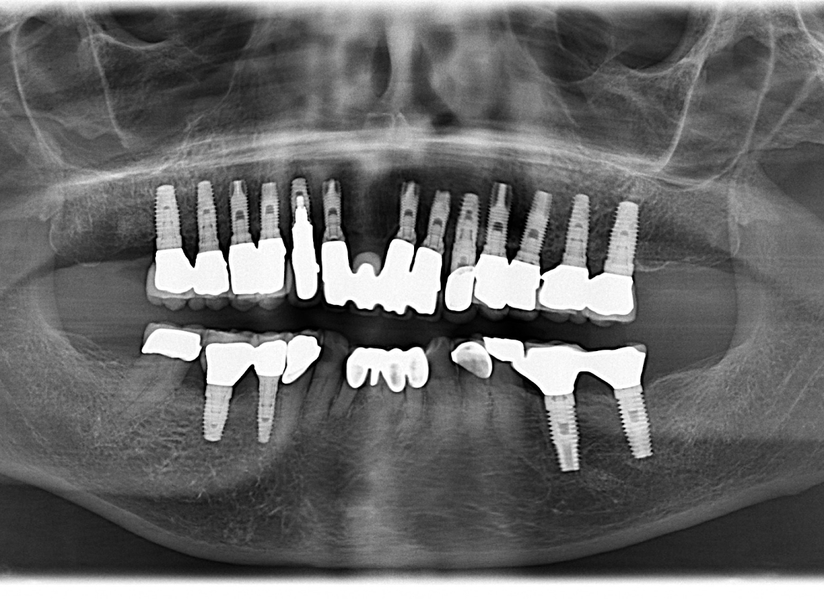 Bayside Periodontics & Dental Implants photo 5