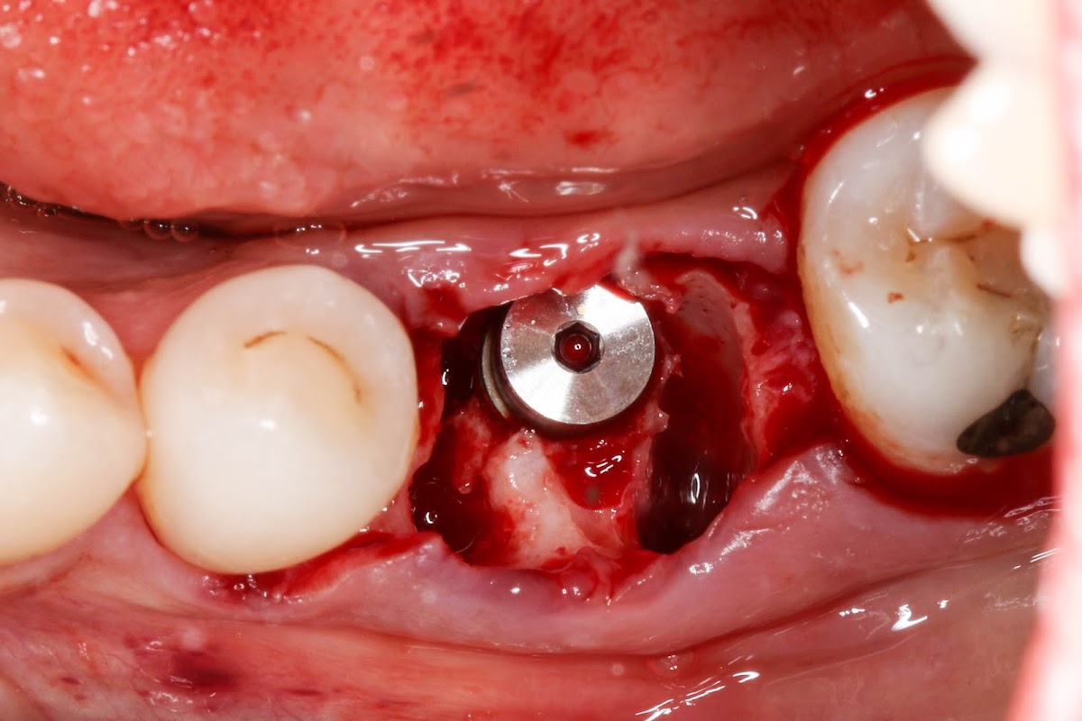 Bayside Periodontics & Dental Implants photo 6