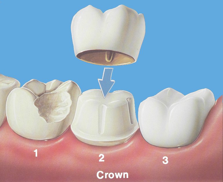 Premier Dental Center Seguin photo 2