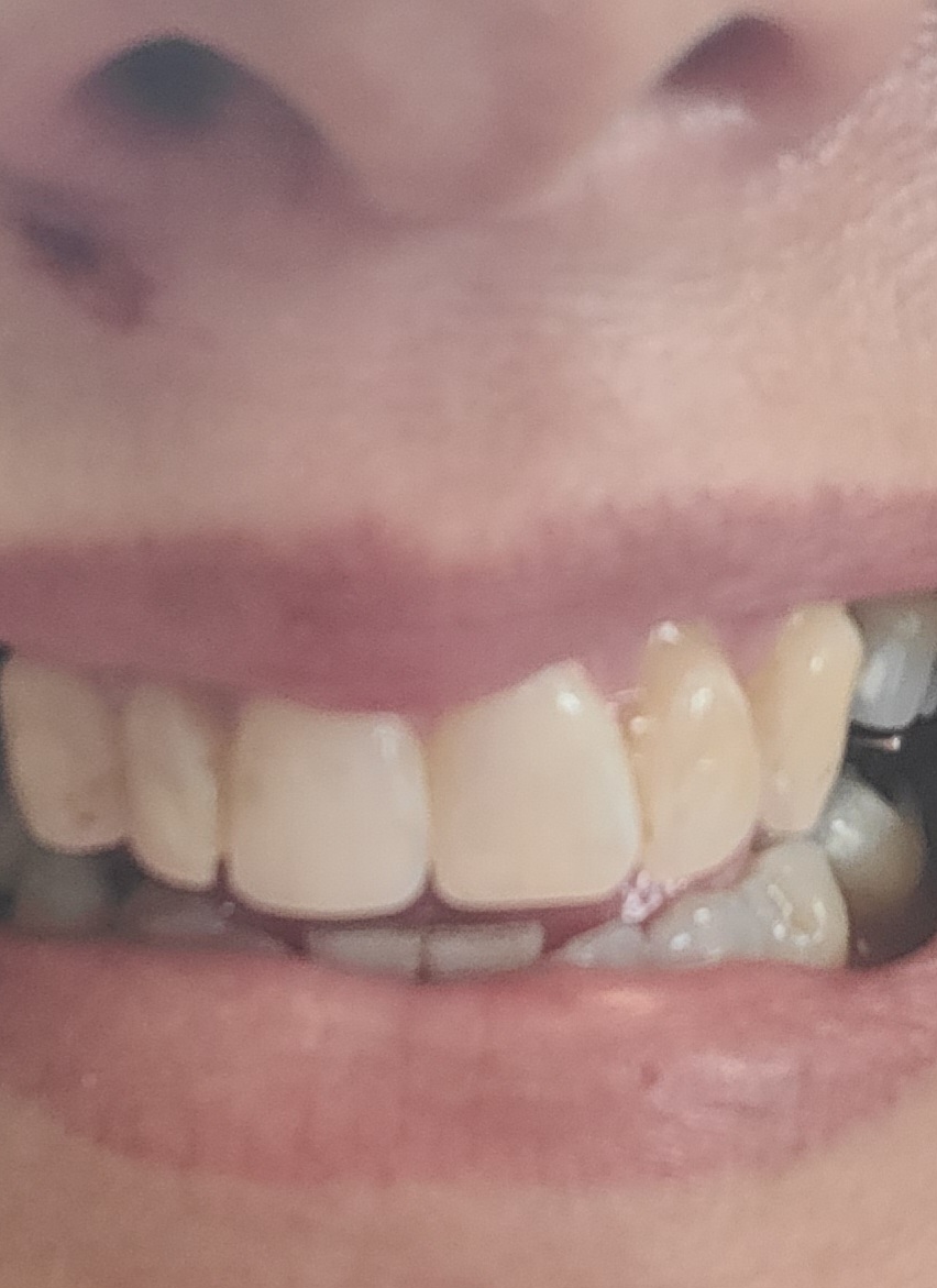 Aspen Dental - Keizer photo 3