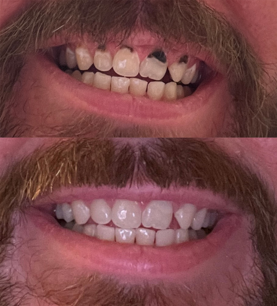 Aspen Dental - Keizer photo 4