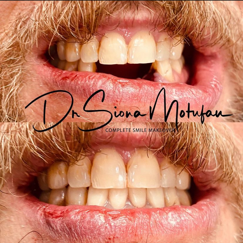 Ohana Dental Implant Centers photo 4