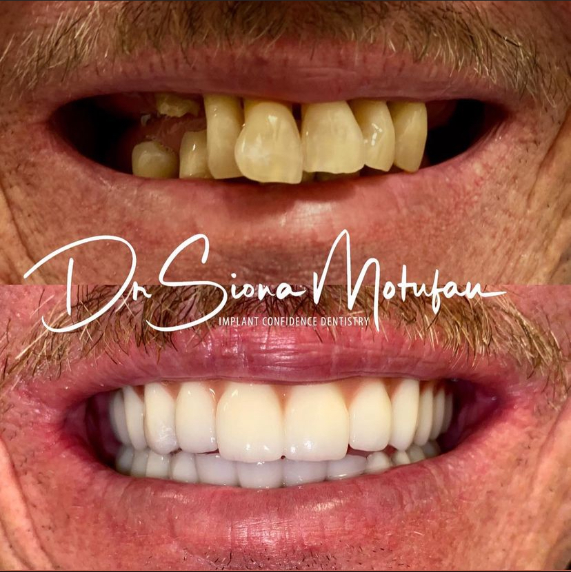 Ohana Dental Implant Centers photo 5