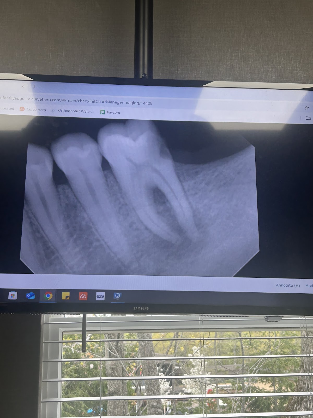 Gentle Family Dentistry - Augusta photo 3