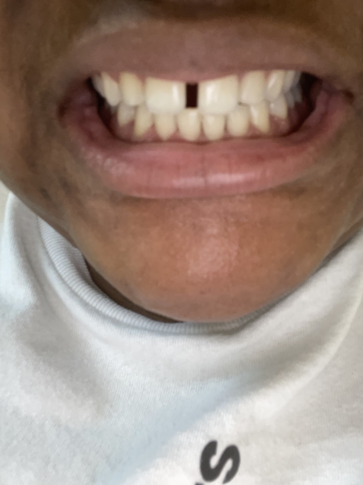 Vicksburg Family Dental 61 North photo 4