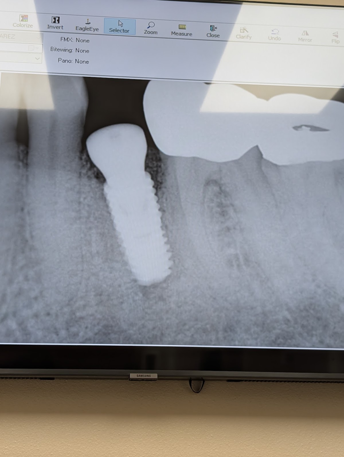 Indio Family Dental Care photo 5