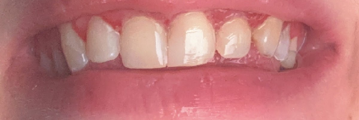 Lake Champlain Dentistry photo 3