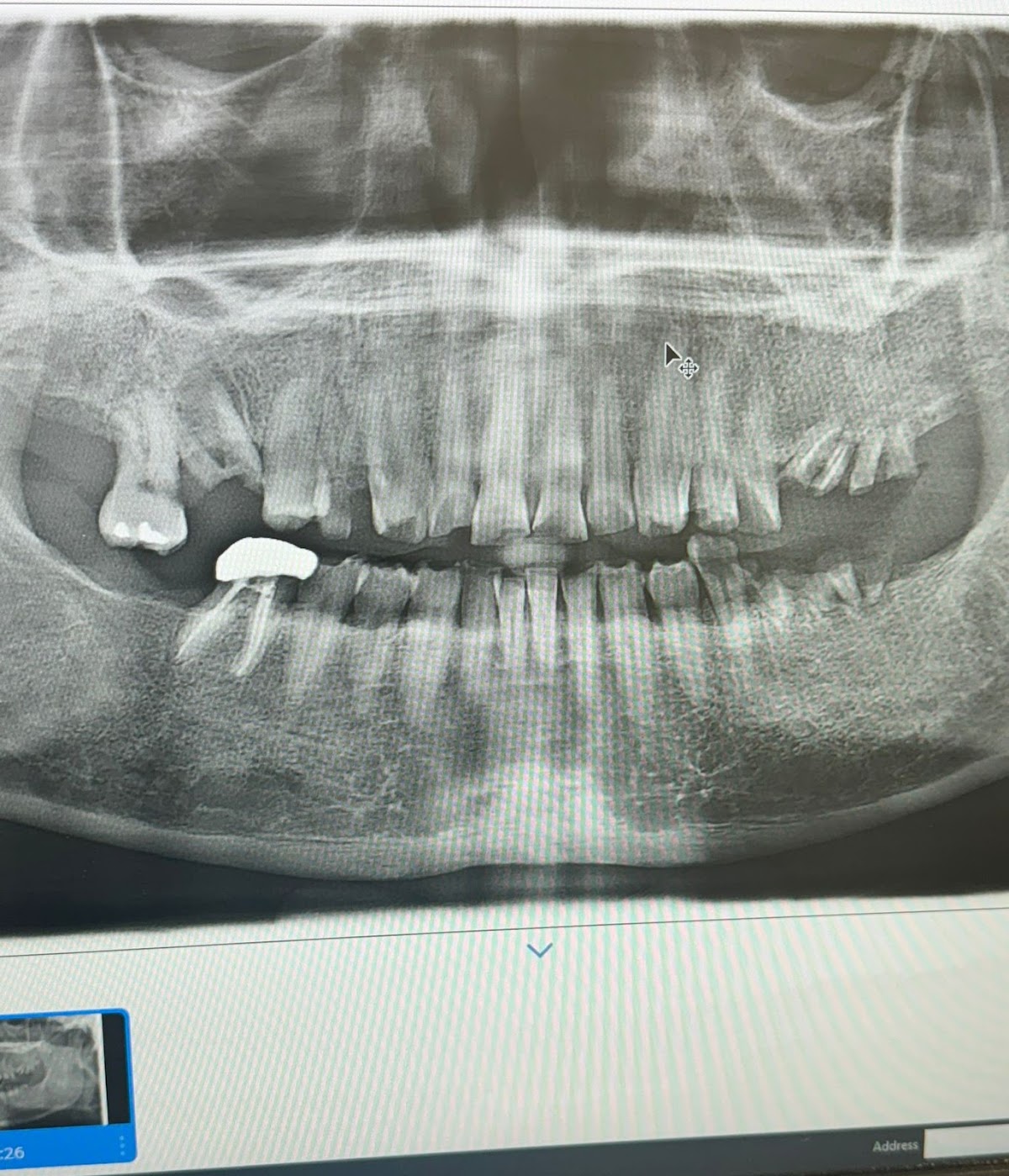 Plumas Family Dentistry & Implant Center photo 5