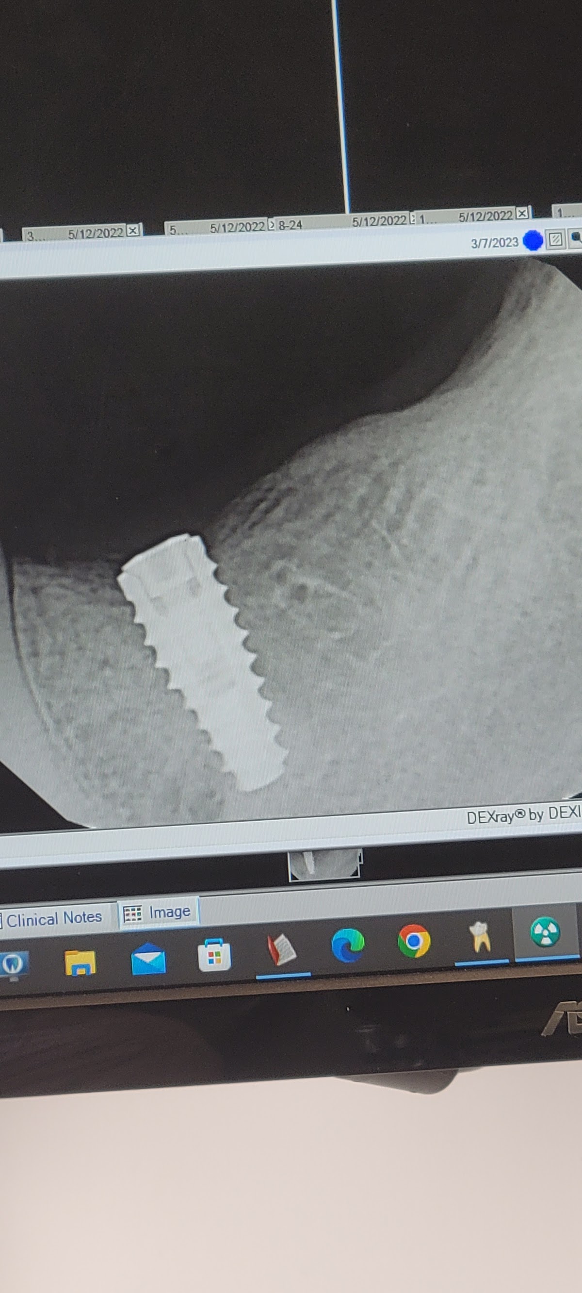 Wy Implants & Surgical Arts photo 3