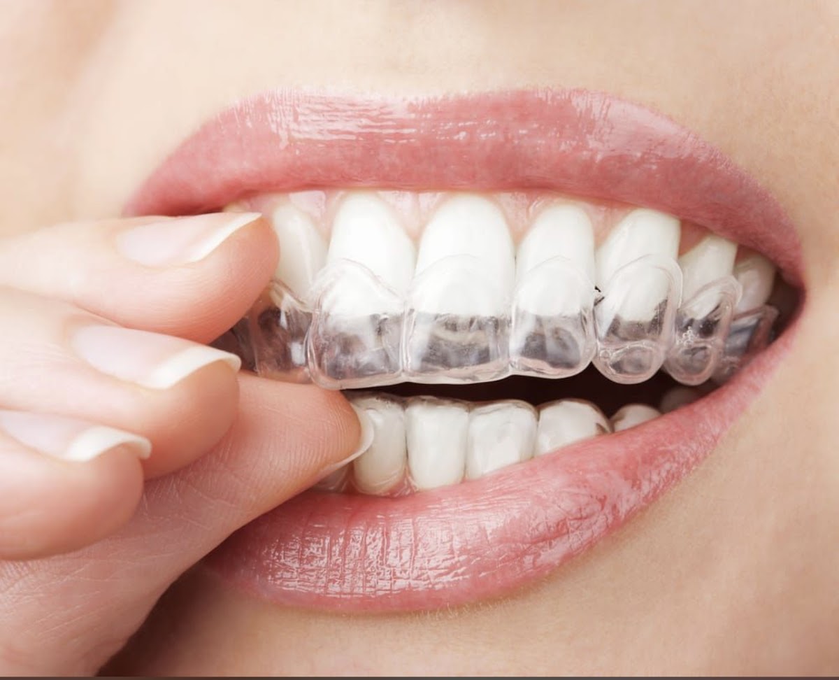 The Downey Dentist photo 5