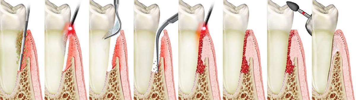 Pinellas Periodontics & Implant Dentistry at Clearwater photo 5