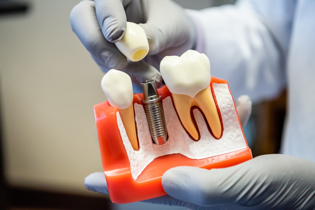 Oakland Dental Implant Center photo 3