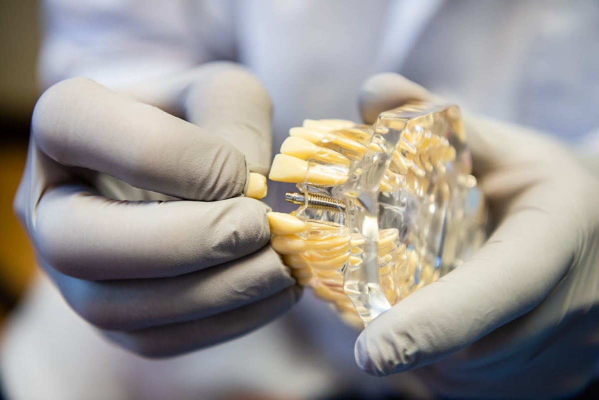 Oakland Dental Implant Center photo 4