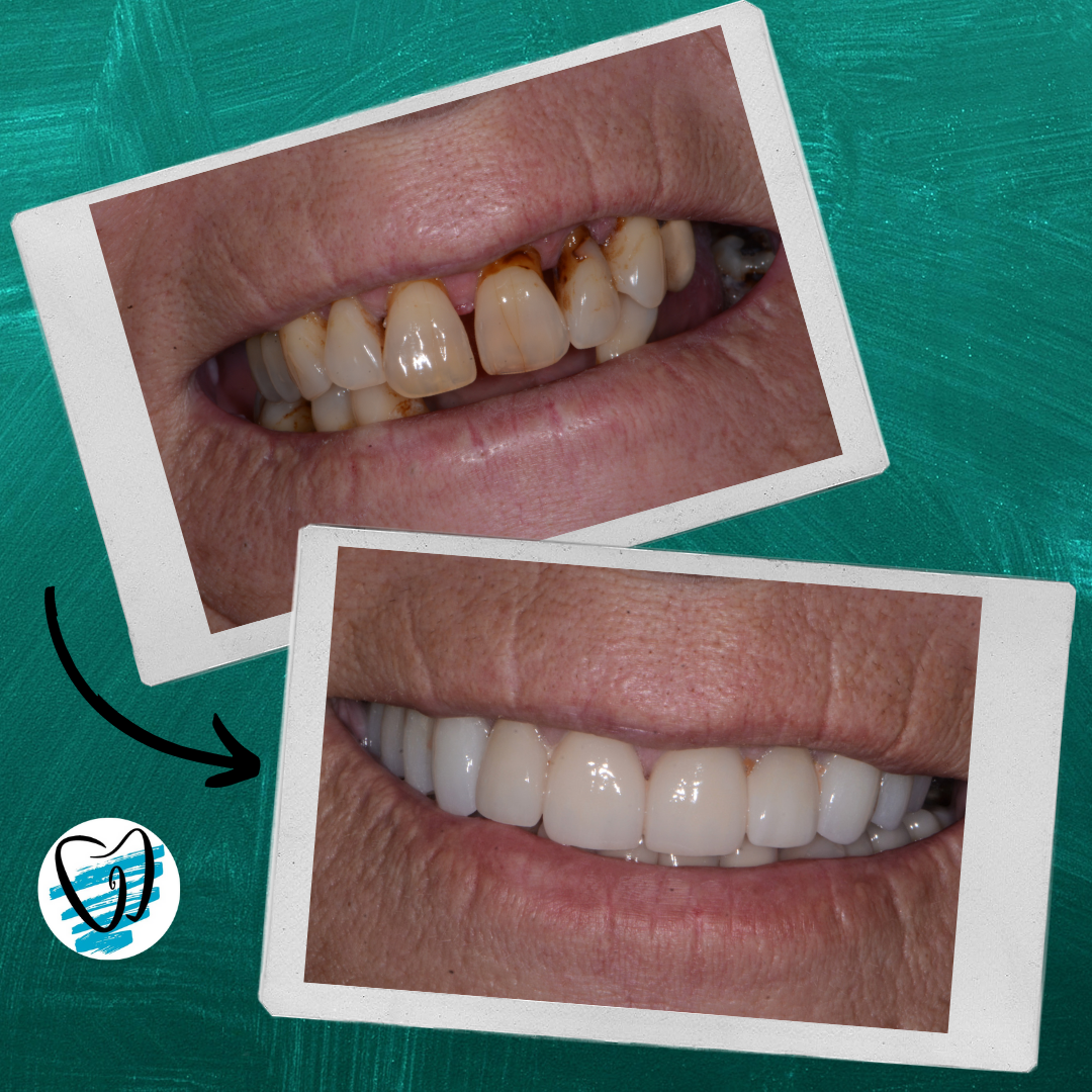 Lake George Family Dentistry photo 6
