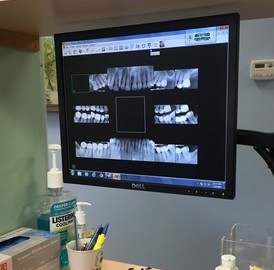 Advanced Dental Technology of Ithaca II PLLC photo 6