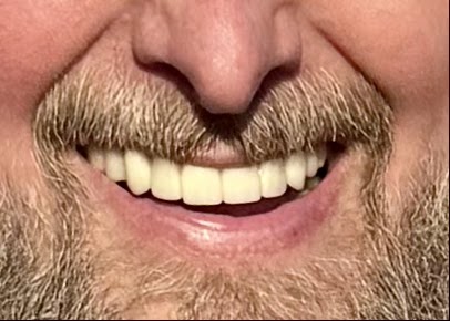 Clearchoice Dental Implant Center - Elk Grove photo 1