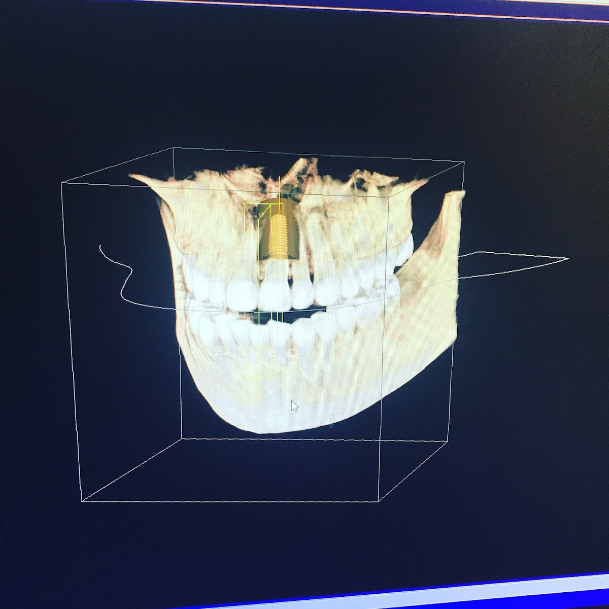 Burgin Dentistry I Jeremy Burgin D.D.S. PC photo 2