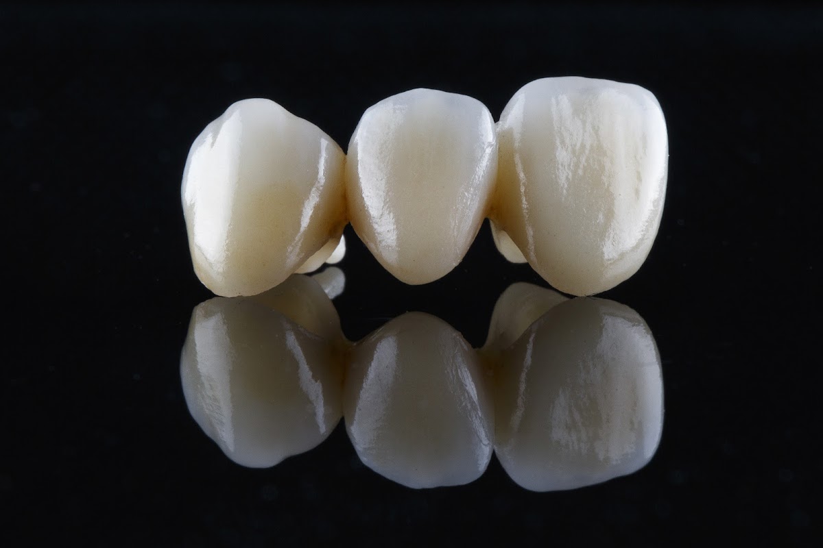 Great Impressions Dental Lab photo 1
