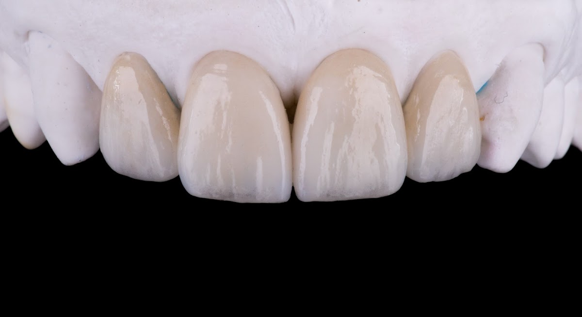 Great Impressions Dental Lab photo 3