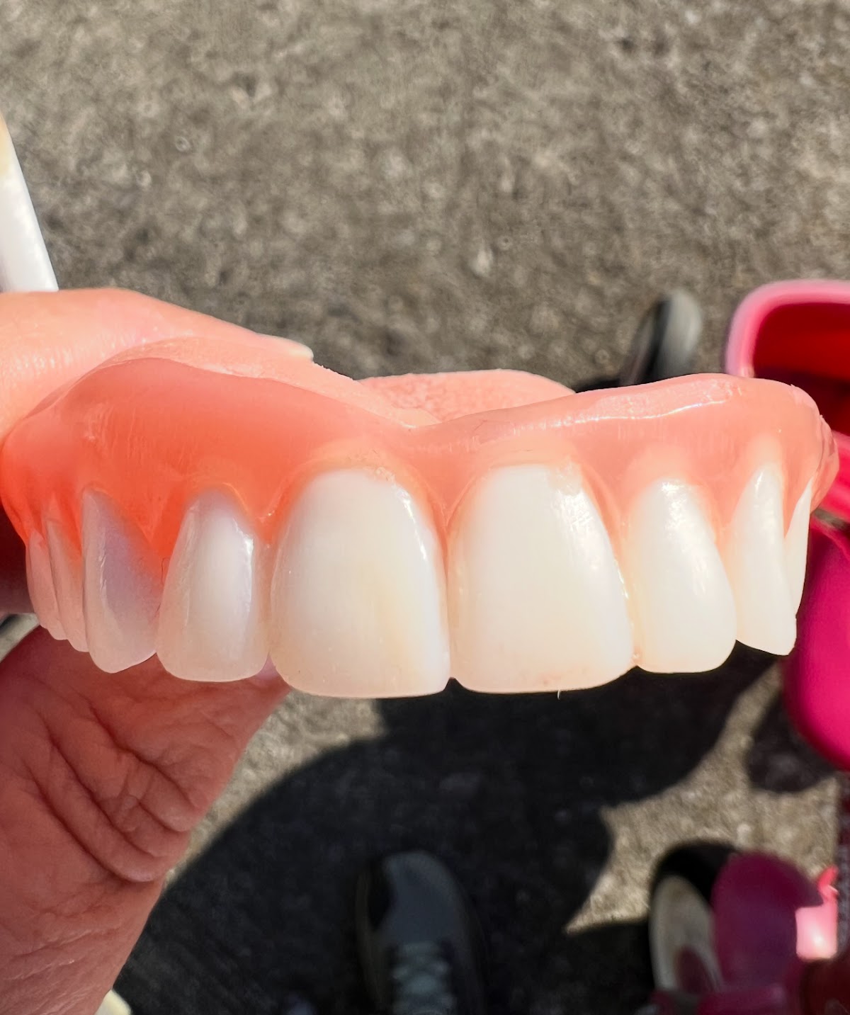 Aspen Dental - Alcoa photo 4
