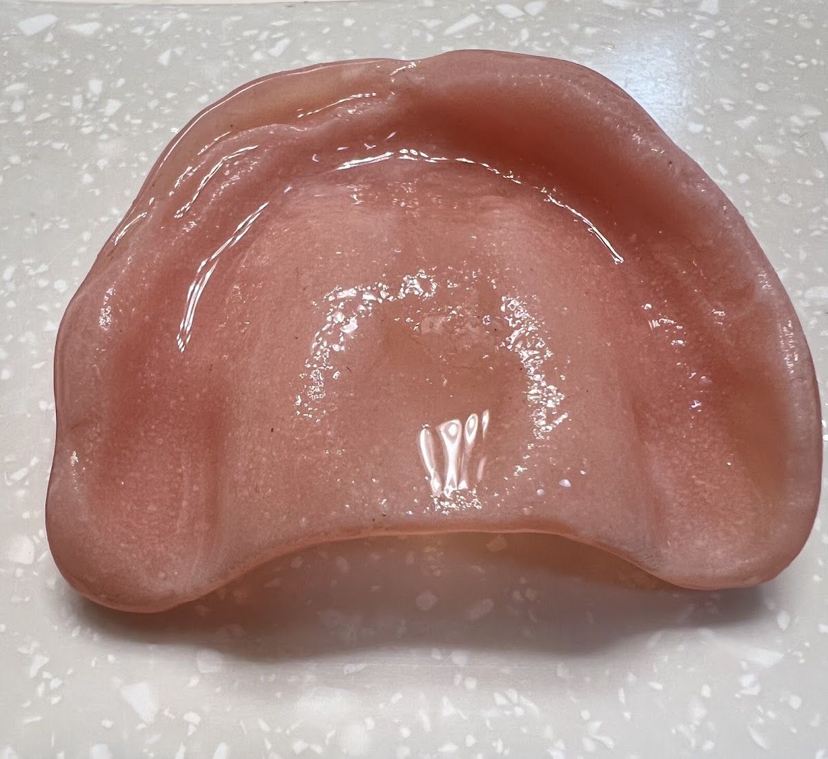 Aspen Dental - Alcoa photo 5