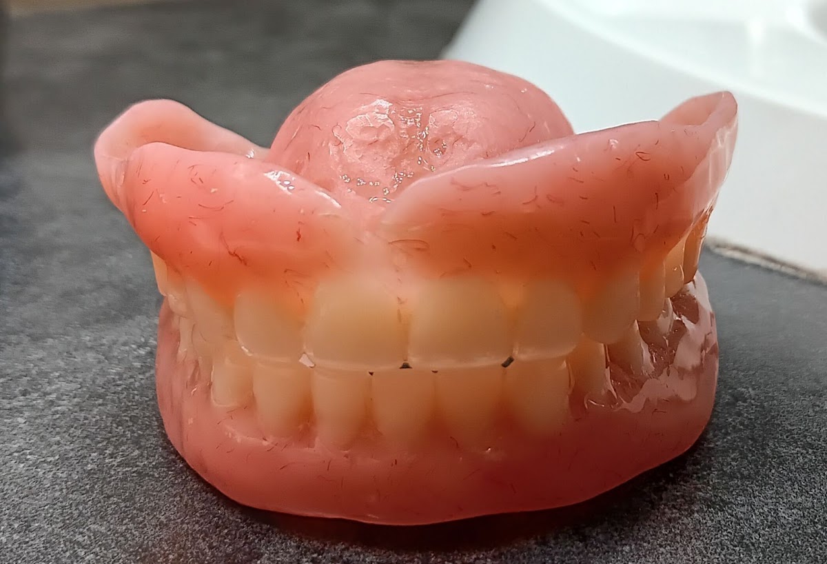 Affordable Dentures & Implants - Monroe photo 2